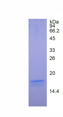 Figure. SDS-PAGE