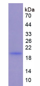 Figure . SDS-PAGE