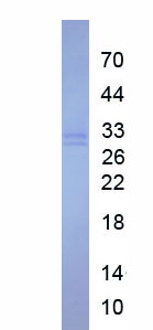 Figure. SDS-PAGE