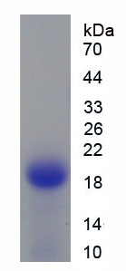 Figure . SDS-PAGE