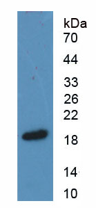 Figure . Western Blot