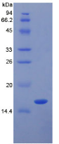 Figure . SDS-PAGE