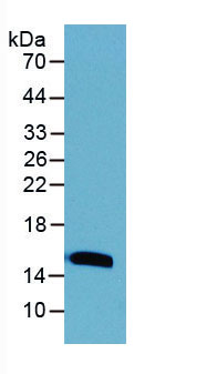 Figure . Western Blot