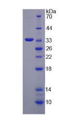 Figure . SDS-PAGE