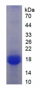 Figure . SDS-PAGE