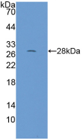Figure . Western Blot