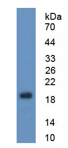 Figure . Western Blot