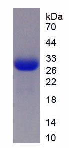 Figure . SDS-PAGE