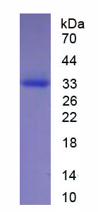Figure . SDS-PAGE