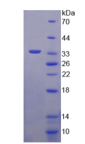 Figure . SDS-PAGE