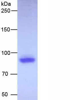 Figure. SDS-PAGE
