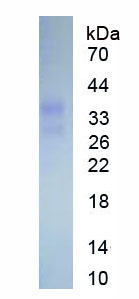 Figure . SDS-PAGE