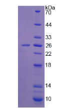 Figure . SDS-PAGE
