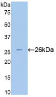 Figure . Western Blot