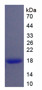 Figure . SDS-PAGE