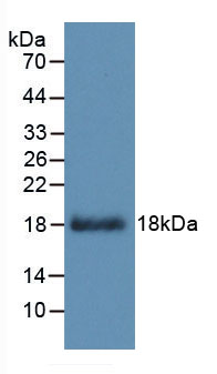 Figure . Western Blot