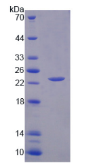 Figure . SDS-PAGE