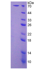 Figure . SDS-PAGE