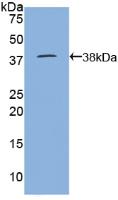 Figure . Western Blot