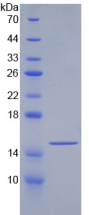 Figure . SDS-PAGE