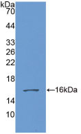 Figure . Western Blot