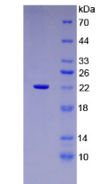 Figure . SDS-PAGE