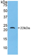 Figure . Western Blot
