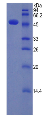 Figure . SDS-PAGE