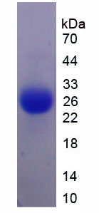 Figure . SDS-PAGE