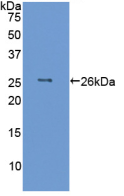 Figure . Western Blot