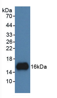Figure . Western Blot