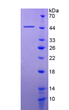 Figure . SDS-PAGE