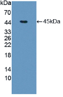 Figure. Western Blot