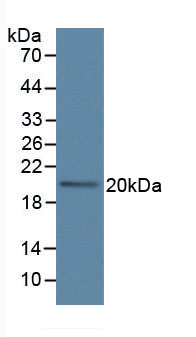 Figure . Western Blot