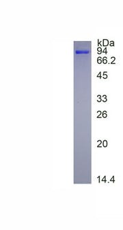 Figure. SDS-PAGE
