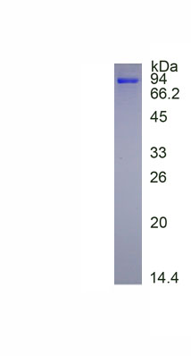 Figure. SDS-PAGE