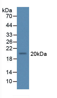 Figure . Western Blot; Sample: Recombinant IL11, Human; Antibody: Rabbit Anti-Human IL11 Ab (PAA057Hu06)