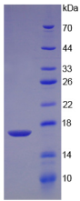 Figure . SDS-PAGE