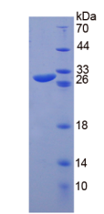 Figure . SDS-PAGE
