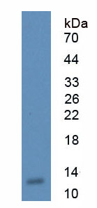 Figure . Western Blot