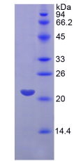 Figure . SDS-PAGE