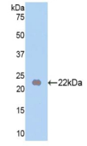 Figure . Western Blot