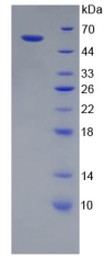 Figure . SDS-PAGE