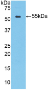 Figure . Western Blot