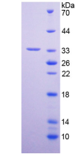 Figure . SDS-PAGE