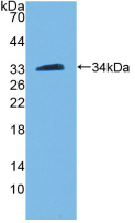Figure . Western Blot