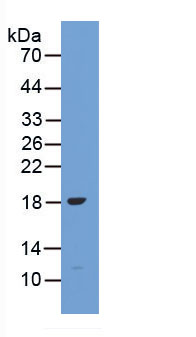 Figure . Western Blot