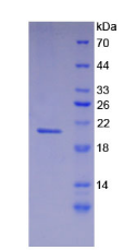 Figure . SDS-PAGE