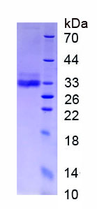 Figure . SDS-PAGE