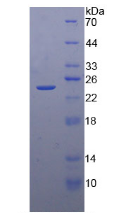 Figure . SDS-PAGE